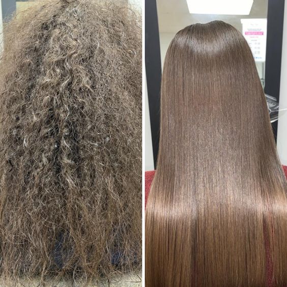 Antes e Depois Organic Lizz