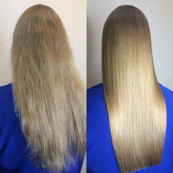 Antes e Depois Organic Lizz