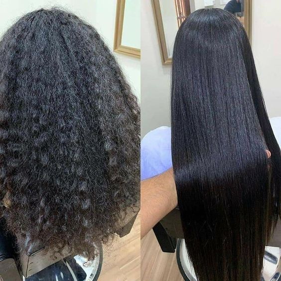 Antes e Depois Organic Lizz